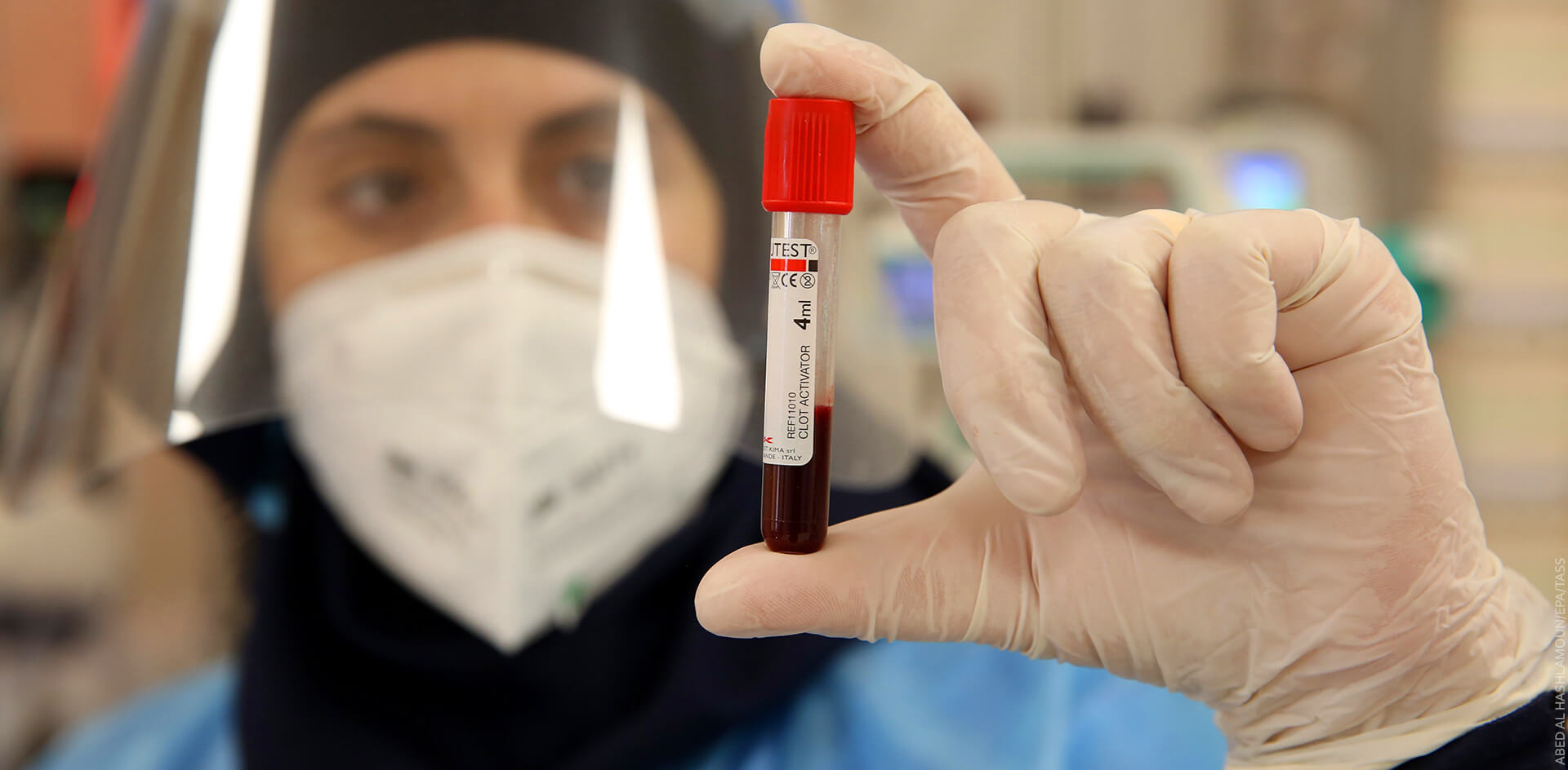 В мире растёт спрос на кровь не вакцинированных от COVID-19 доноров