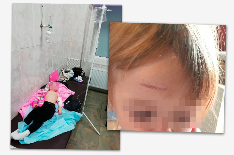 Одна из воспитанниц детского сада «Лучик» во время пребывания в группе получила серьёзную травму головы.