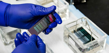 Т-клетки в фокусе внимания